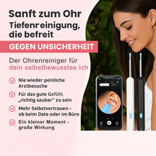 Lade das Bild in den Galerie-Viewer, OhrCam – Smarter Ohrenreiniger
